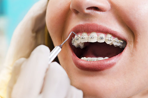 Dentclinic Vision - Smile Brilliance